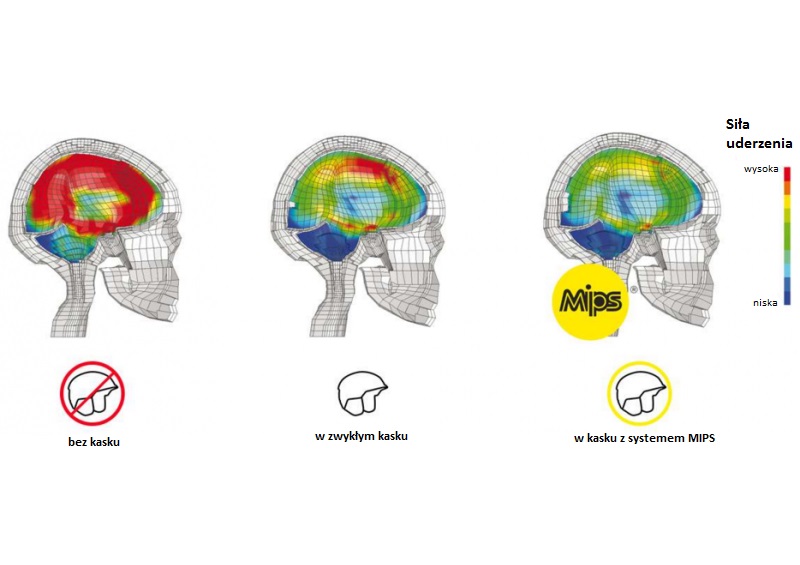 Porównanie oddziaływania sił na mózg z systemem MIPS  i bez niego